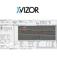 X-Vizor - ПО для компьютерной радиографии